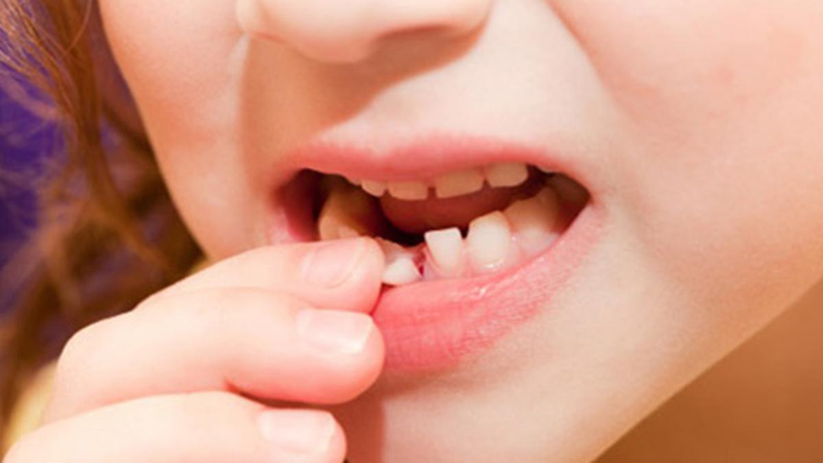 Chiêm bao thấy rụng răng không chảy máu có độc hay không?